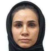 زهرا دهقانی